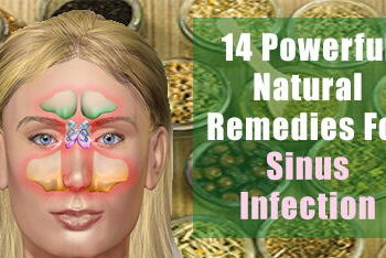 Sinus infection