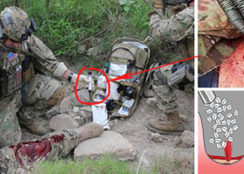 Emergency Care For Gunshot Wounds