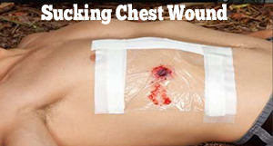 Sucking Chest Wound