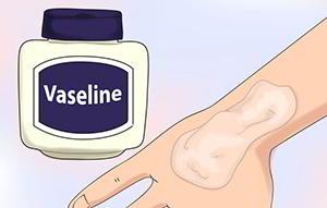 1-vaseline