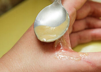 alternative uses for honey