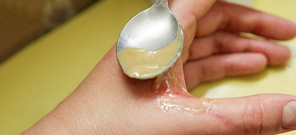 alternative uses for honey