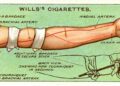 15 Lost Emergency Care Tips From 100 Years Ago