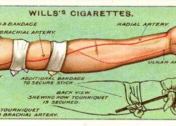 15 Lost Emergency Care Tips From 100 Years Ago