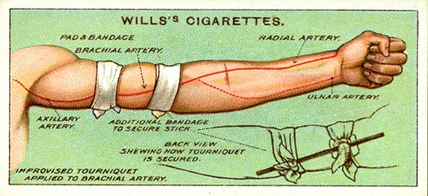 15 Lost Emergency Care Tips From 100 Years Ago