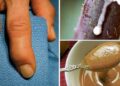 12 Old Fashioned Arthritis Remedies Your Ancestors Used v2