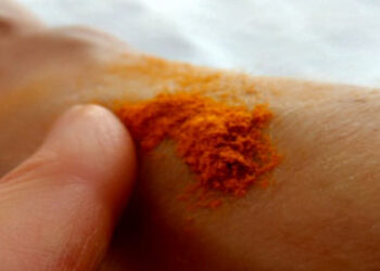 6 Kitchen Ingredients That Work Like Medicines