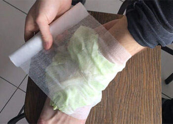 How to Make Cabbage Bandages to Treat Inflammation and Joint Pain