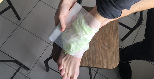 How to Make Cabbage Bandages to Treat Inflammation and Joint Pain