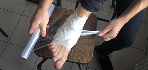 How to Make Cabbage Bandages to Treat Inflammation and Joint Pain