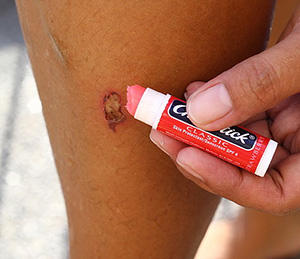 20 Survival Uses For Chapstick