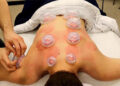 How To Use The Old Cupping Method To Get Rid Of Back Pain