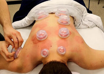 How To Use The Old Cupping Method To Get Rid Of Back Pain