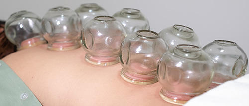 How To Use The Old Cupping Method To Get Rid Of Back Pain