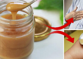 The Antibiotic Honey That Shouldn’t Be Missing From Your Stockpile