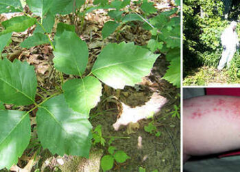 How to Get Rid of Poison Ivy