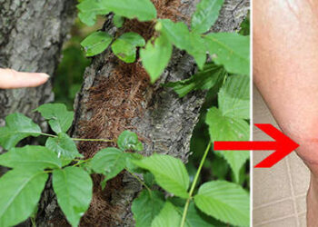 The Best Natural Treatments for Poison Ivy and Poison Oak
