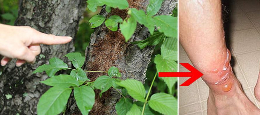 Poison Ivy Treatment The-Best-Natural-Treatments-for-Poison-Ivy-and-Poison-Oak-890x395_c