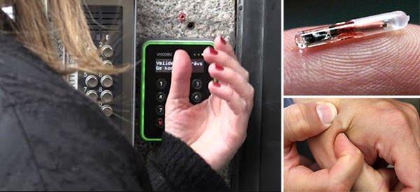 NBC News Thinks Getting Microchipped Sounds Super-Convenient