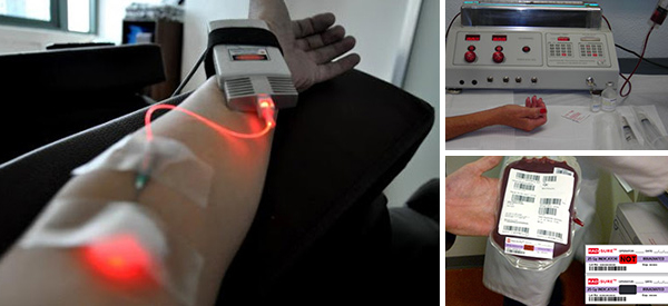 Ultraviolet Blood Irradition – The Cure That Time Forgot