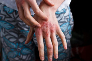 10 Medical Home Emergencies and How to Manage Them