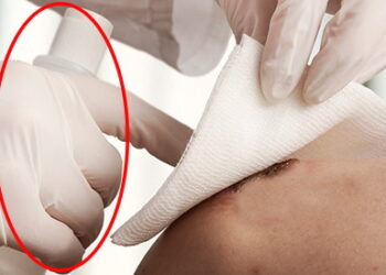 10 Medicinal Uses Of Alcohol You Can Benefit From Right Now