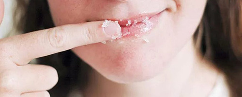 Exfoliate Your Lips and Skin