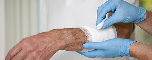 Flushing Wounds