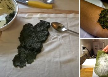 My Grandmother’s Favorite Poultice to Treat Infections