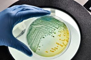 4 Diseases That Could Become Deadly After SHTF