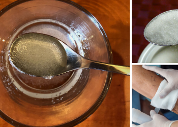 How To Treat And Heal Wounds With Sugar