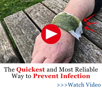 The Quickest and Most Reliable Way to Prevent Infection_MK