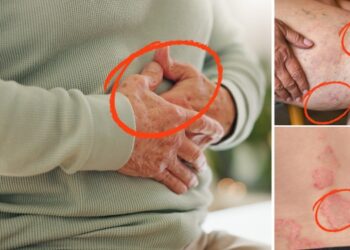 25 Health Issues That Will Kill You Post-SHTF (1)