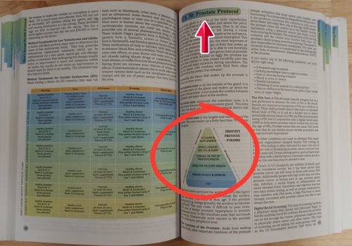 Prostate protocol review