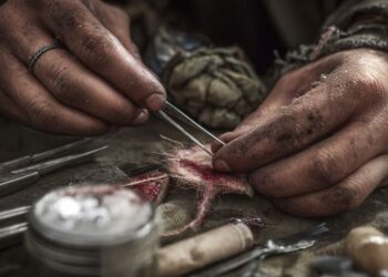 how to remove sutures yourself